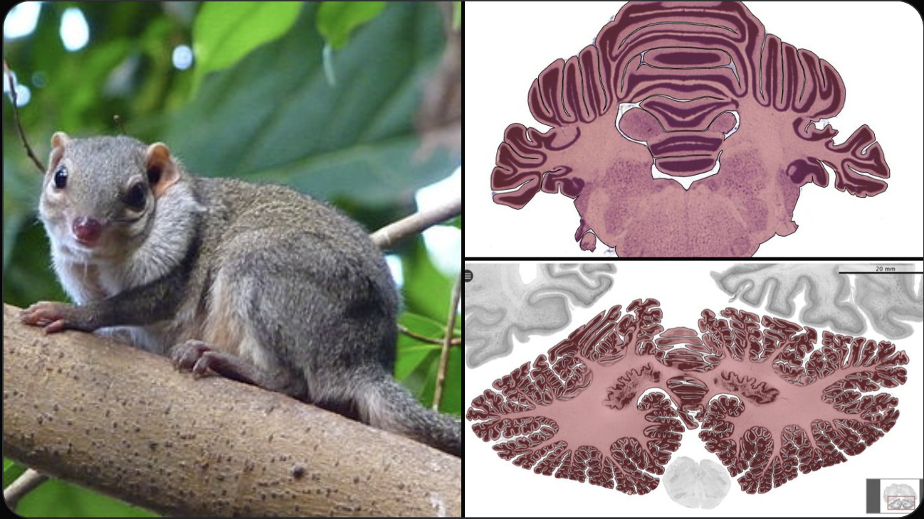 cerebellum3